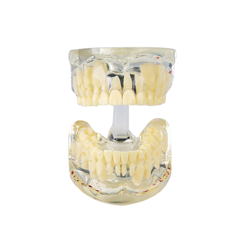 UM-7016 Transparent Model for Baby Teeth（7 years old)