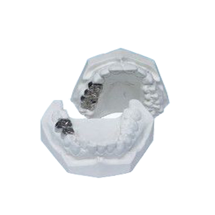 UM-U5 Casting Crown Prosthodontic Model