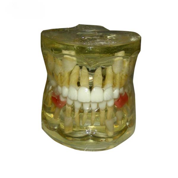 UM-7019 Ранняя потеря патологической модели первичных зубов