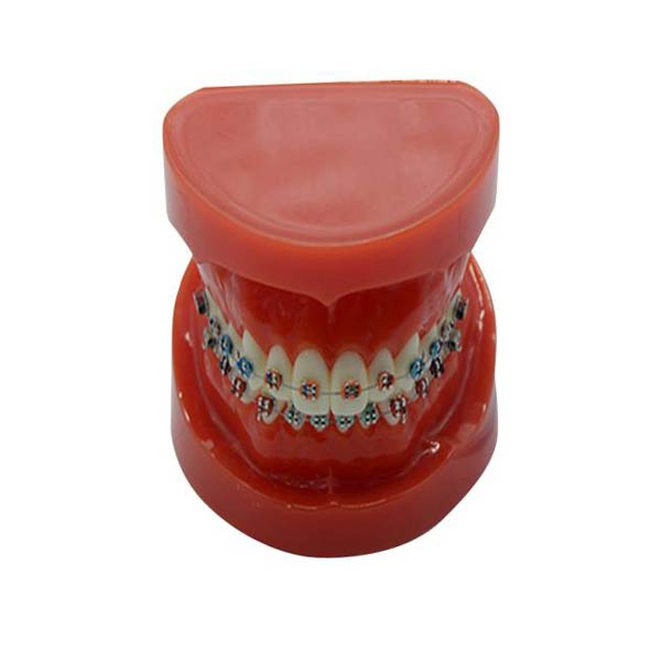 UM-B16 Учебная модель с фиксированными брекетами на зубах (нормальный)