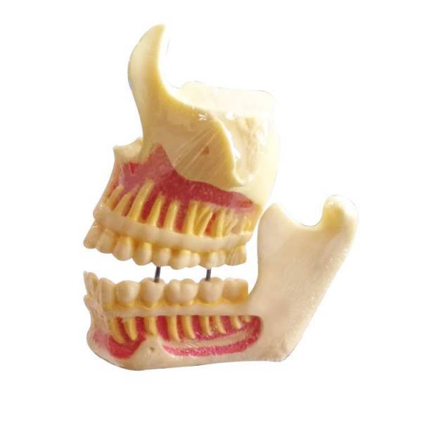 UM-F1 Образовательные модели верхней челюсти и нижней челюсти